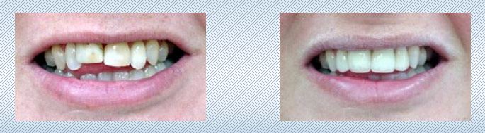 cosmetic dentist san antonio